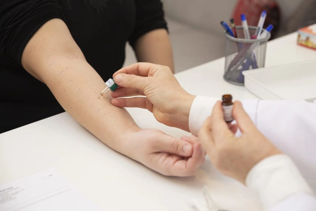 Deri Prick Testi Nedir? Nasıl Yapılır?