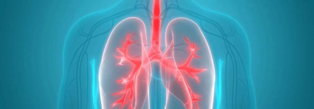 Göğüs Hastalıkları