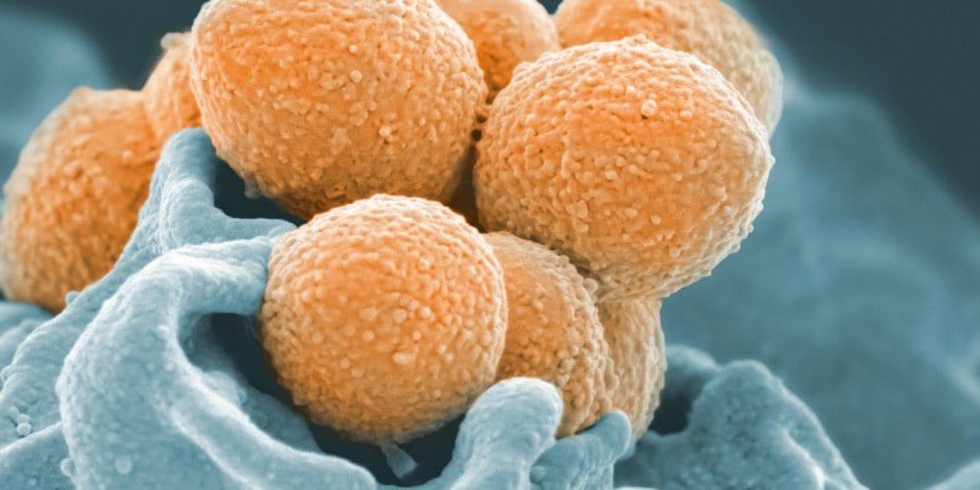 Küf Mantarı Alerjisi Nedir? Belirtileri Nelerdir?