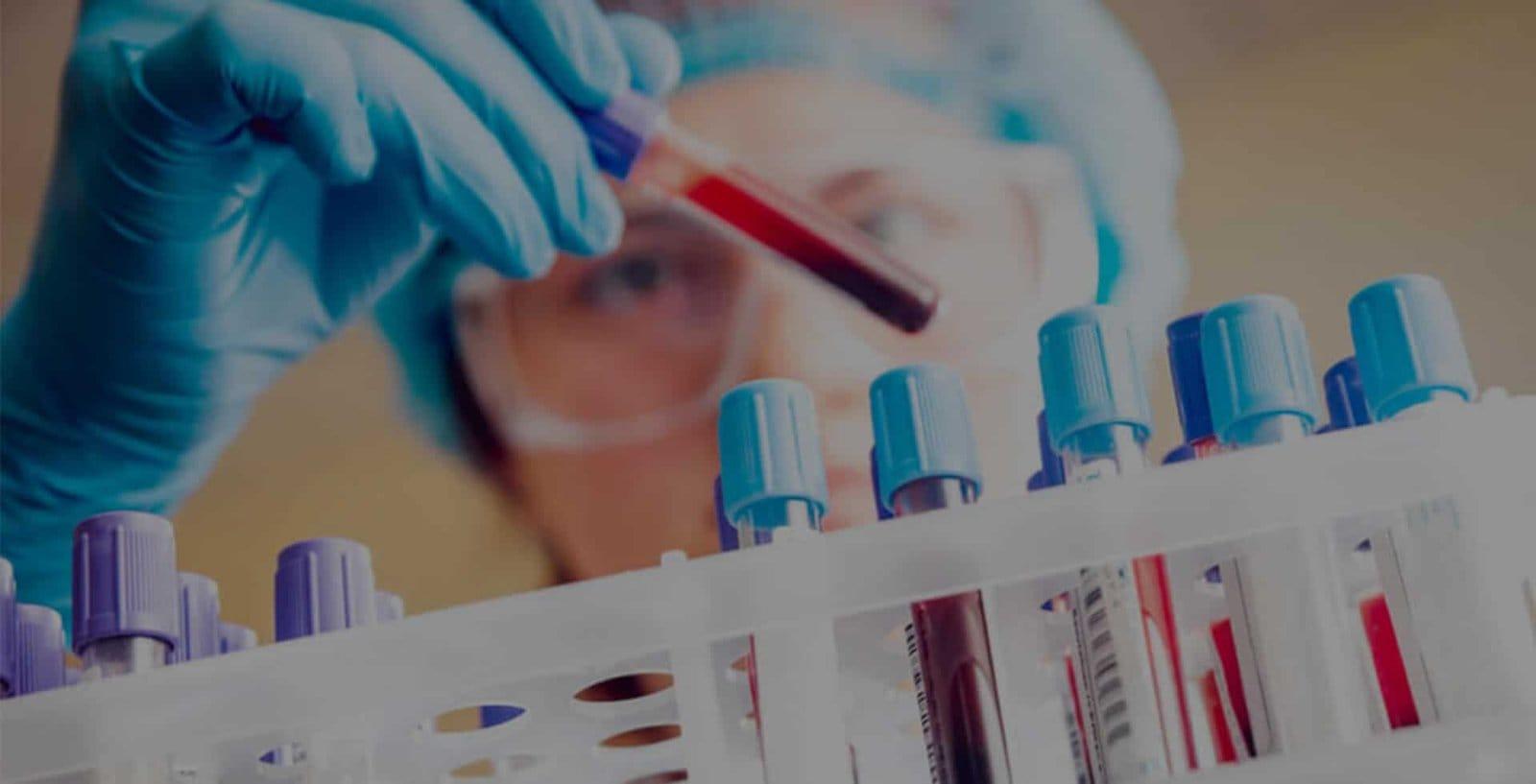 Moleküler Alerji Testi Nedir? Nasıl Yapılır?